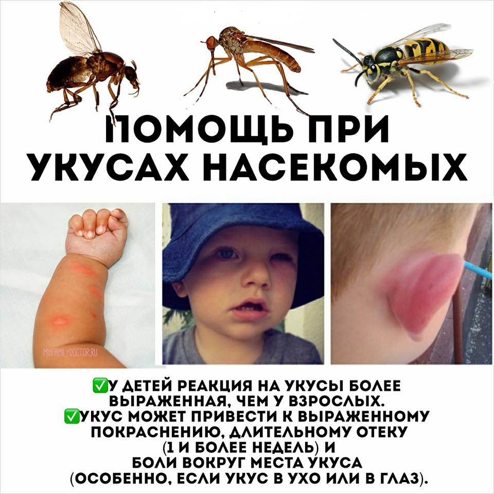 Укусы насекомых для дошкольников