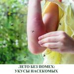 Лето без помех: укусы насекомых